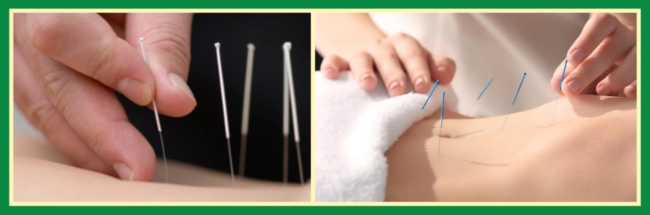 Fertility support acupuncture in Ashbourne and Dunshaughlin - Acupuncture Ashbourne
