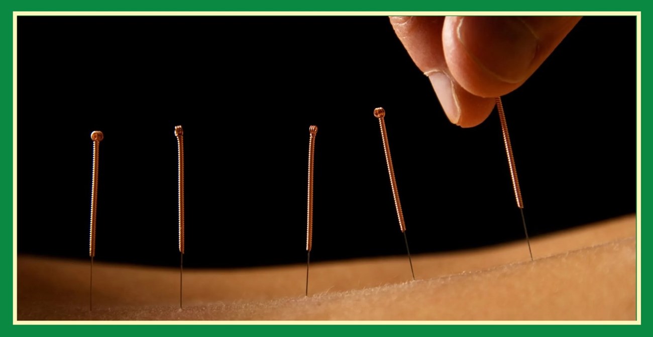 Health benefits of acupuncture in Ashbourne and Dunshaughlin - Acupuncture Ashbourne